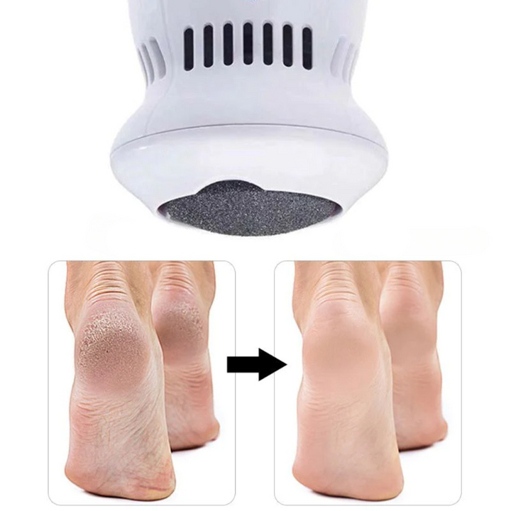 Domowy pedicure: elektryczny pilnik do stóp z wbudowanym odkurzaczem dla higienicznej pielęgnacji i zdrowych stóp.