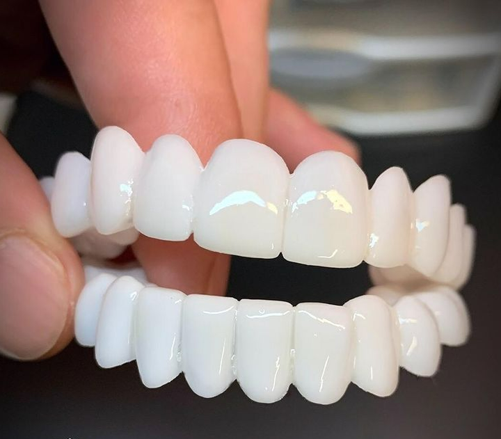 Estetyczne licówki porcelanowe dla pięknego i pewnego uśmiechu, poprawiające wygląd zębów.