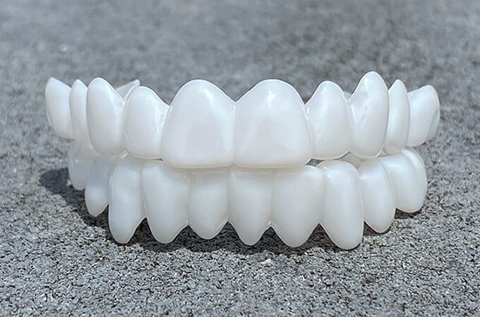 Profesjonalne licówki ceramiczne do korekty estetyki zębów i metamorfozy uśmiechu.